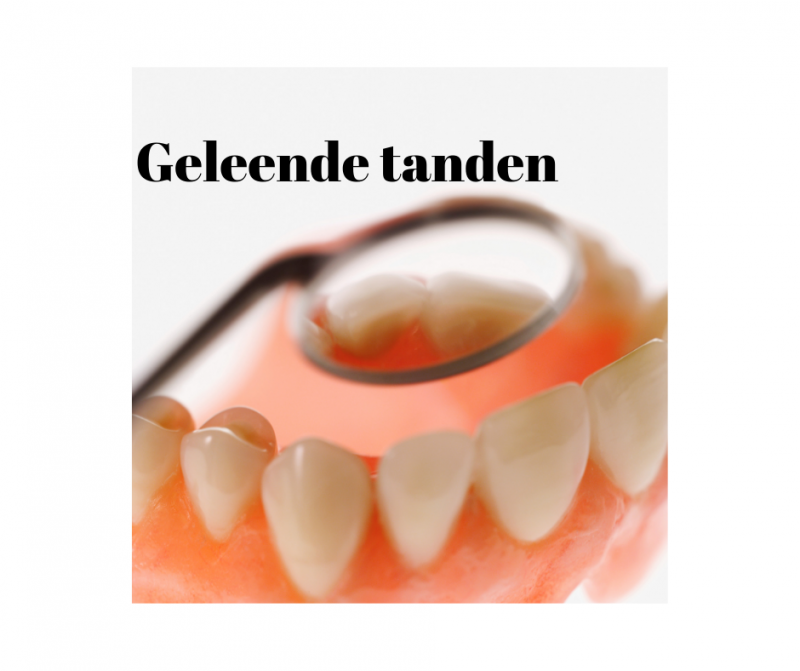 Geleende tanden